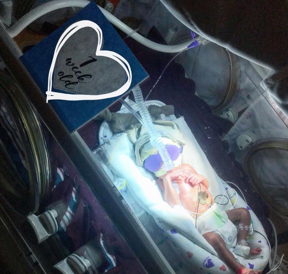 Kangaroo Care skin on skin contact in the neonatal unit with Three Little Tots NICU Milestone Cards. Makes a great gift for new preemie parents